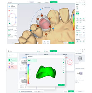 CAD/CAM SOFTWARE Design and Production of Digital Prosthetics
